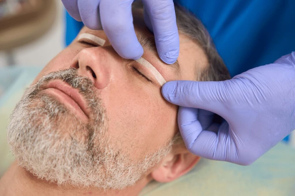 Blefaroplastia segura previne complicações graves
